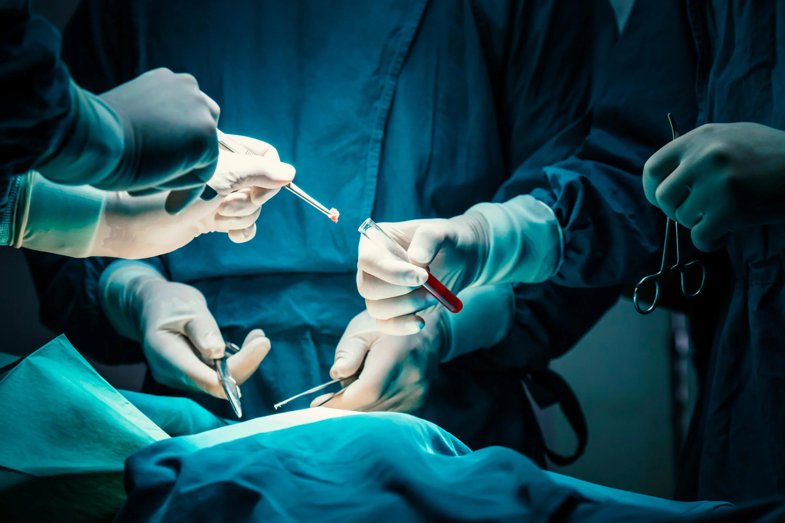 Chirurgie majeure chez les seniors : quand le cerveau garde la trace de l’opération