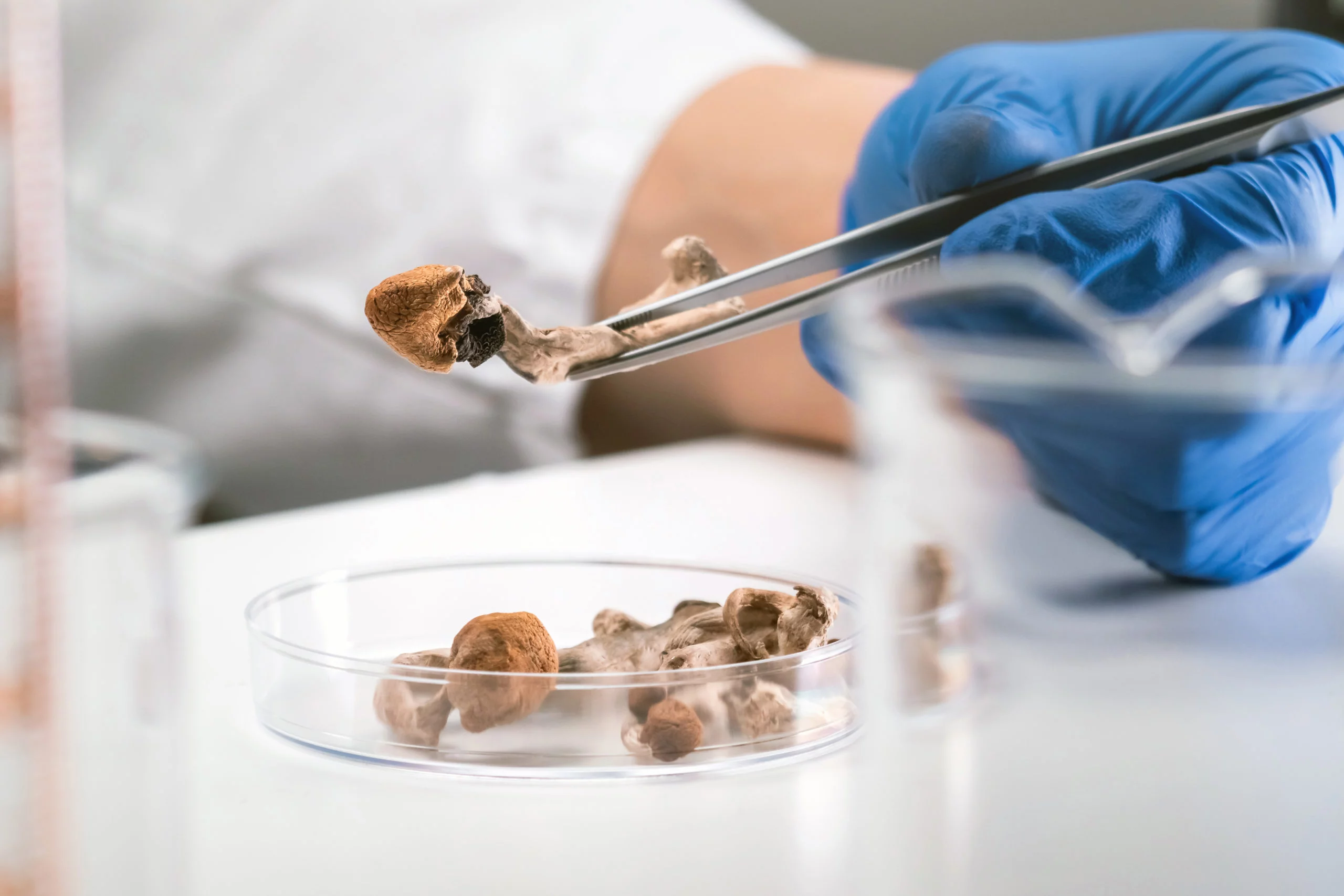 Psilocybine et Alzheimer avancé : un signal clinique intrigant, mais très préliminaire