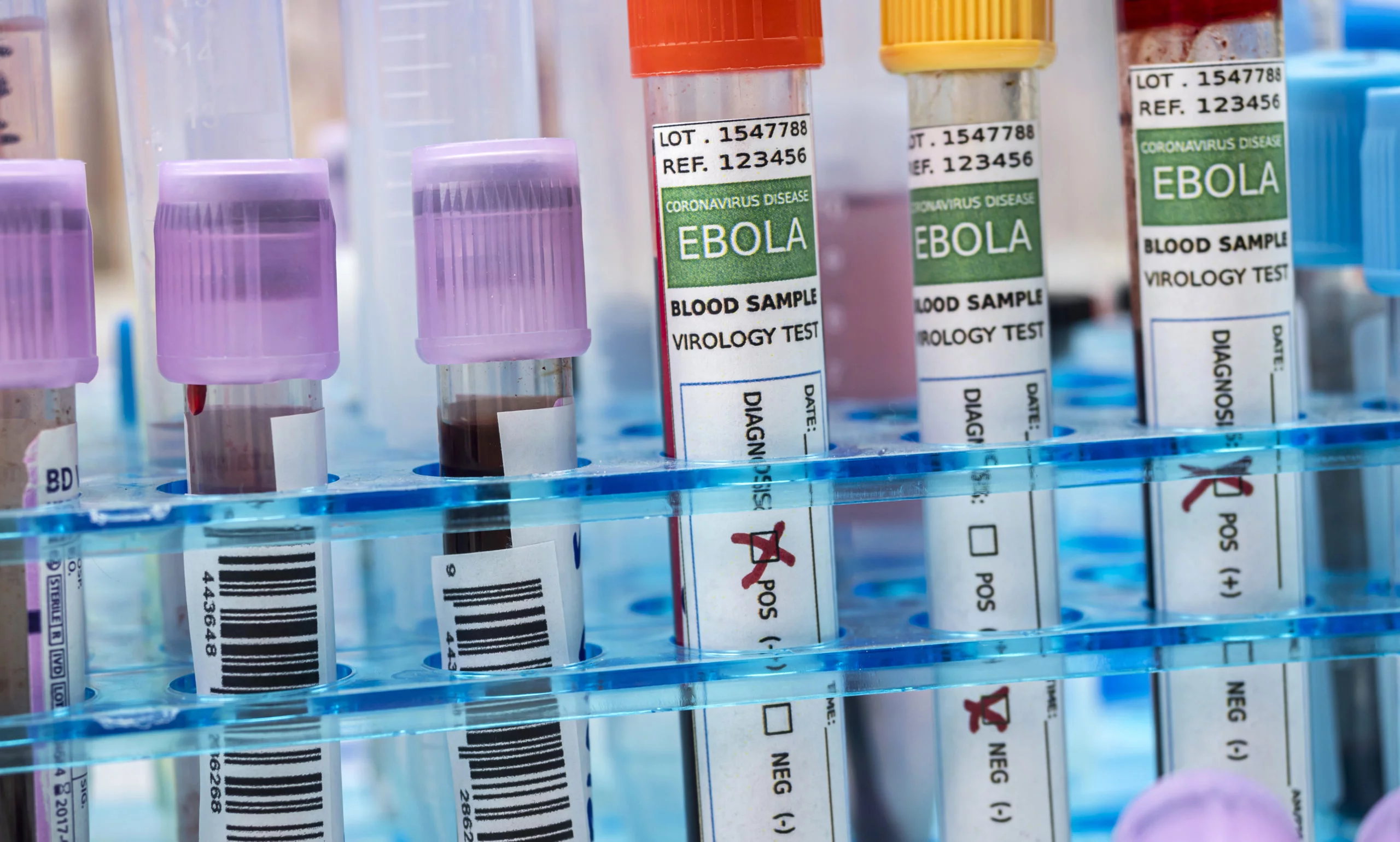  Ebola : une pilule antivirale testée en prévention après exposition