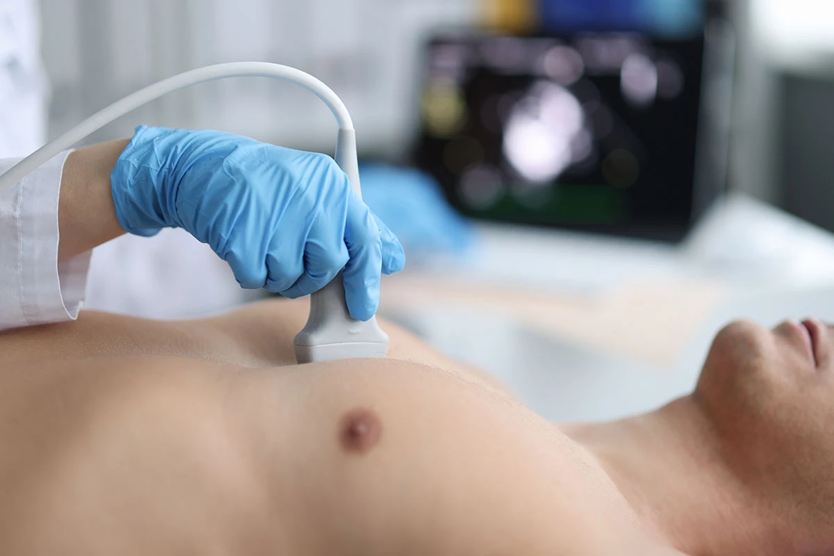 Cardiomyopathie hypertrophique non obstructive : des résultats positifs pour l’aficamten